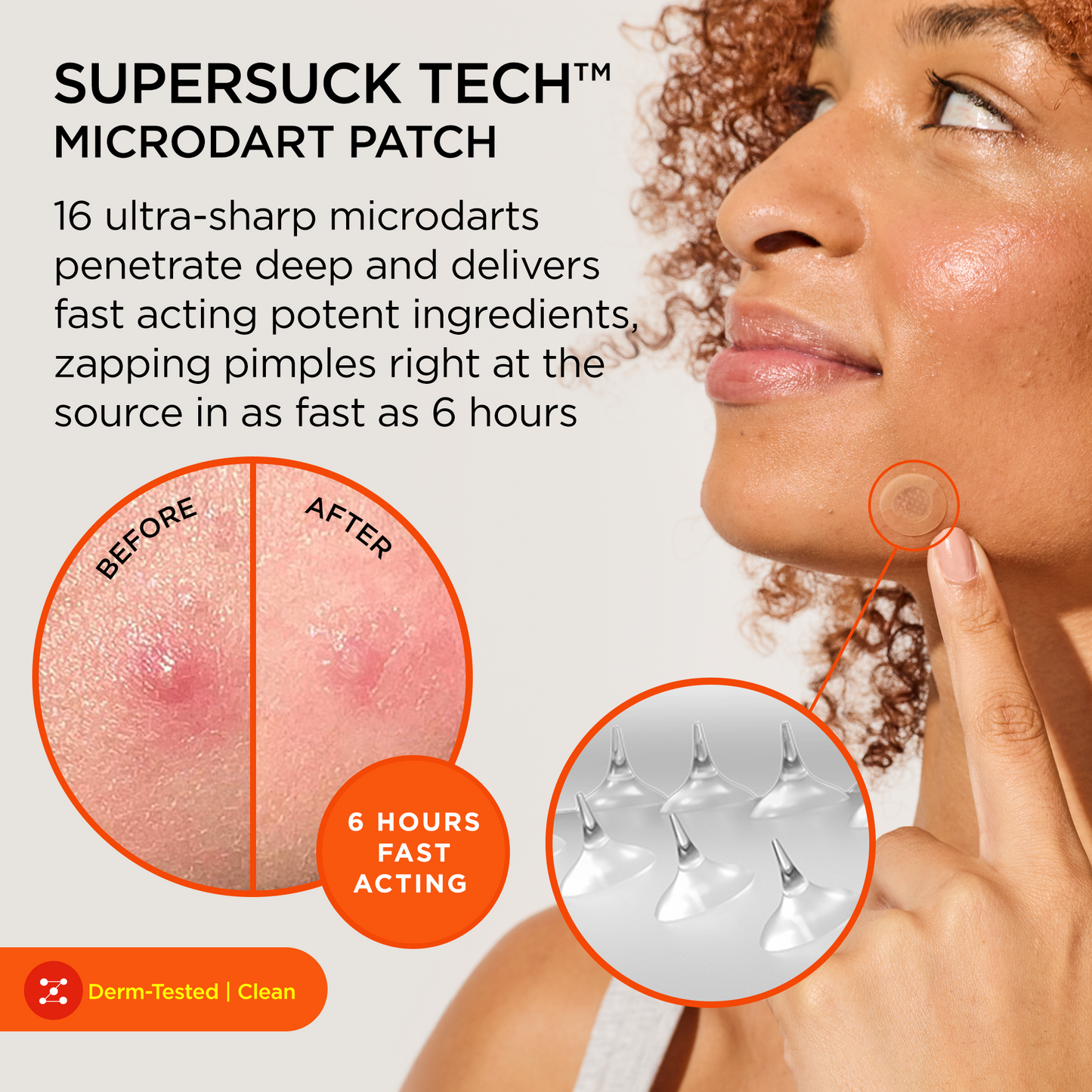 Woman uses KILLA Mini Microdart Pimple Patches; insets show spot control before/after results.