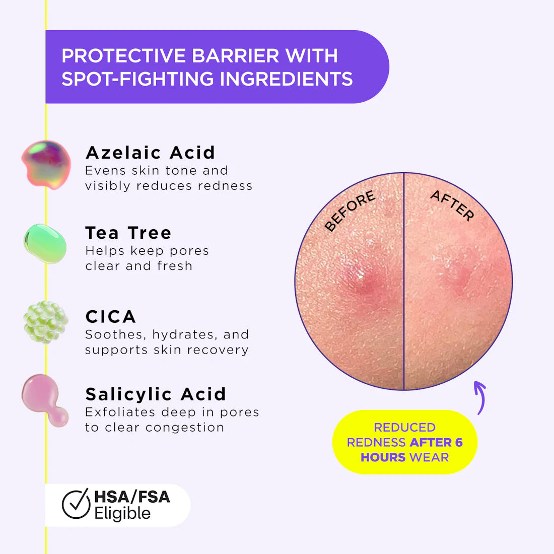 Diagram showing Undercover Liquid Patch spot-fighting with before/after photos for redness reduction.