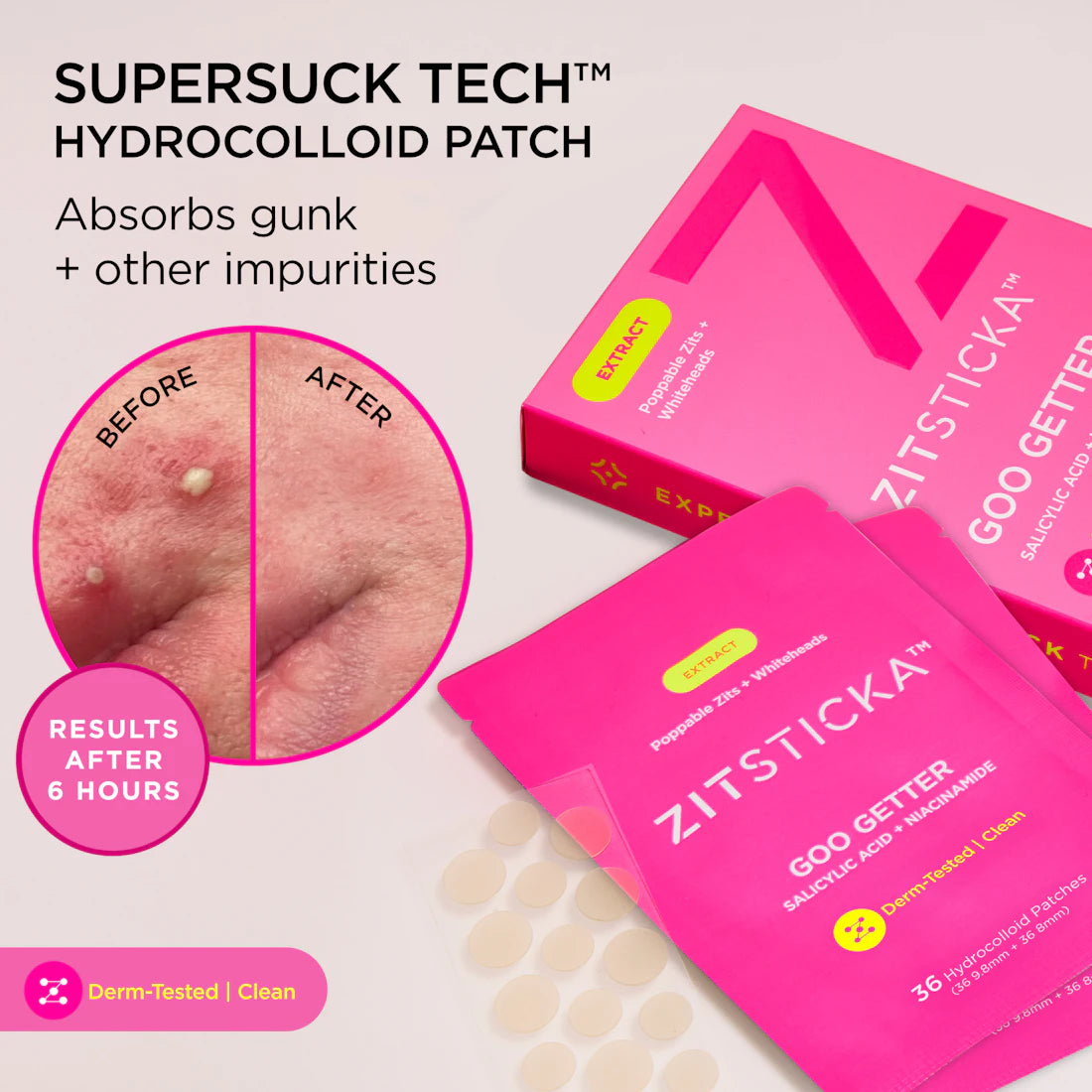 GOO GETTER Hydrocolloid Surface Pimple Patches shown with before-and-after results and patch sheet.