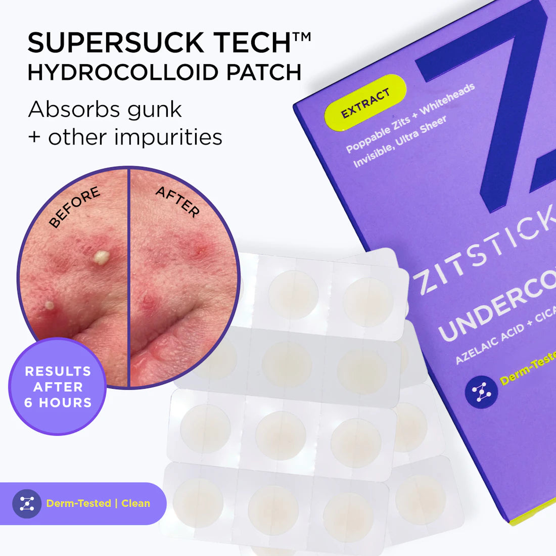 UNDERCOVER Ultra Sheer Hydrocolloid Pimple Patches are invisible spot treatments for clearer skin.