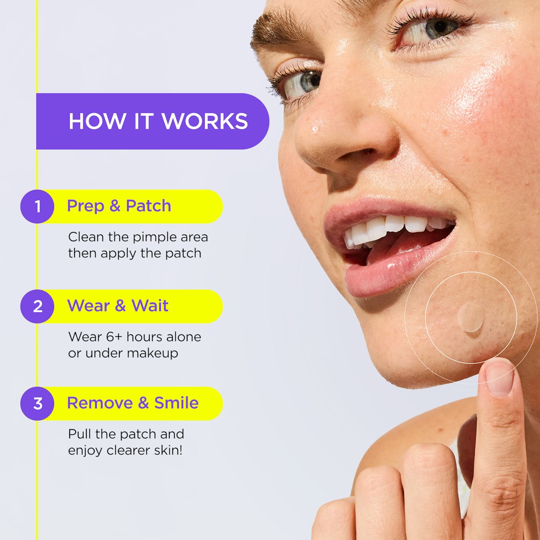 A woman points to her cheek; steps show using UNDERCOVER Ultra Sheer Pimple Patches for clearer skin.