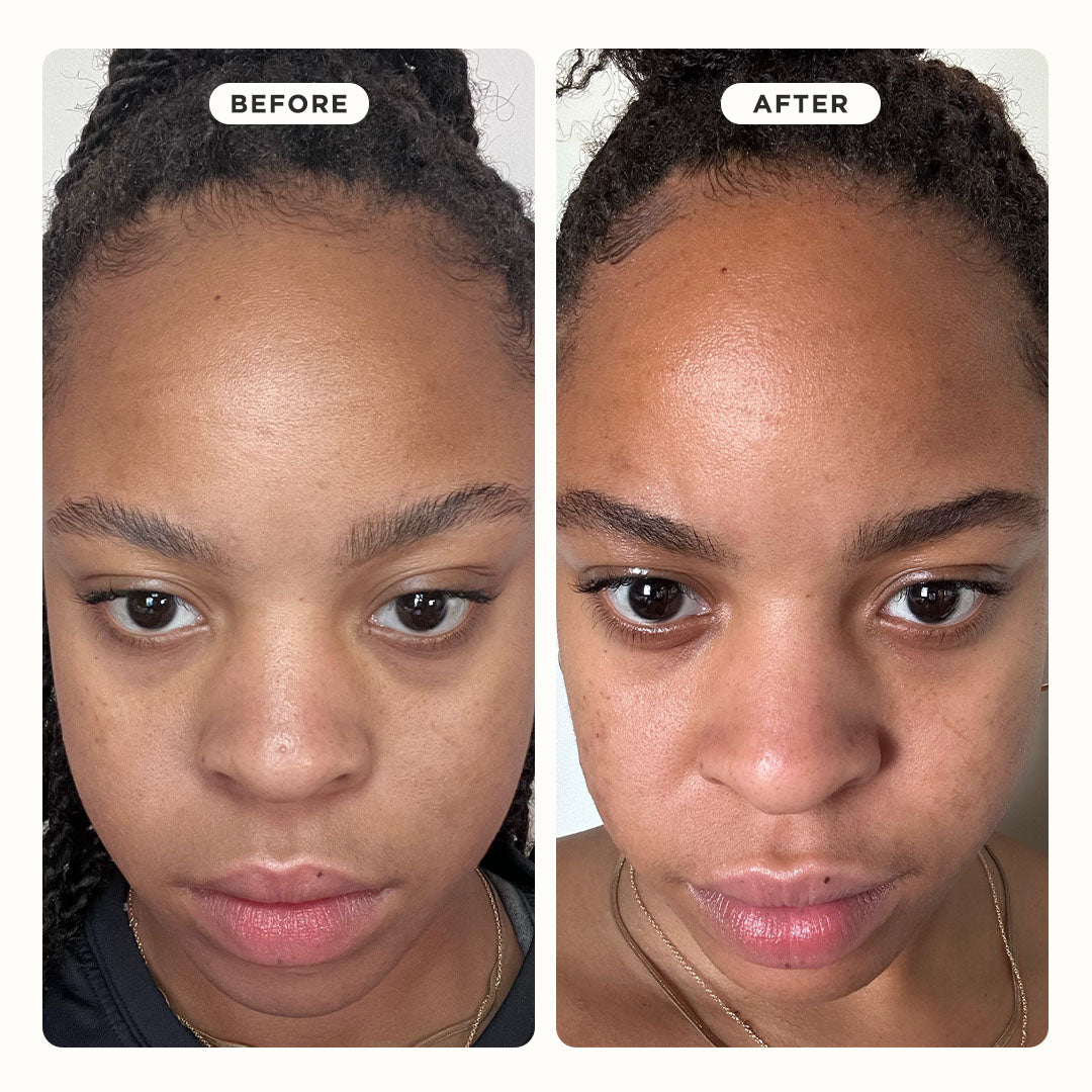 Side-by-side of a woman’s face; after using GOO GETTER™ Nose, her skin is smoother with fewer blackheads.