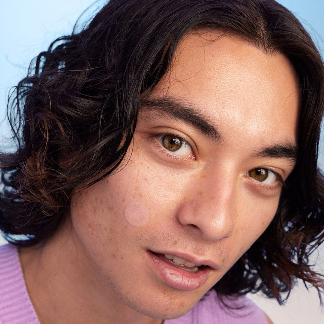 Young person with long hair smiles confidently, wearing HYPERFADE Microdart Blur Patches for clearer skin.