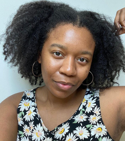 Hyperpigmentation: Worse for Black + Brown Skin?