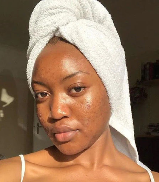 How to block dark spots, acne & look dewy—all at once