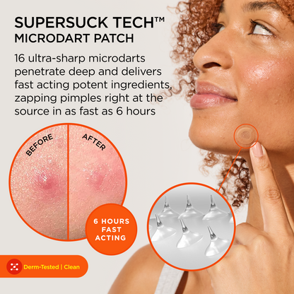 KILLA Mini Microdart Pimple Patches