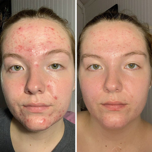 NEW + IMPROVED SKIN DISCIPLINE™