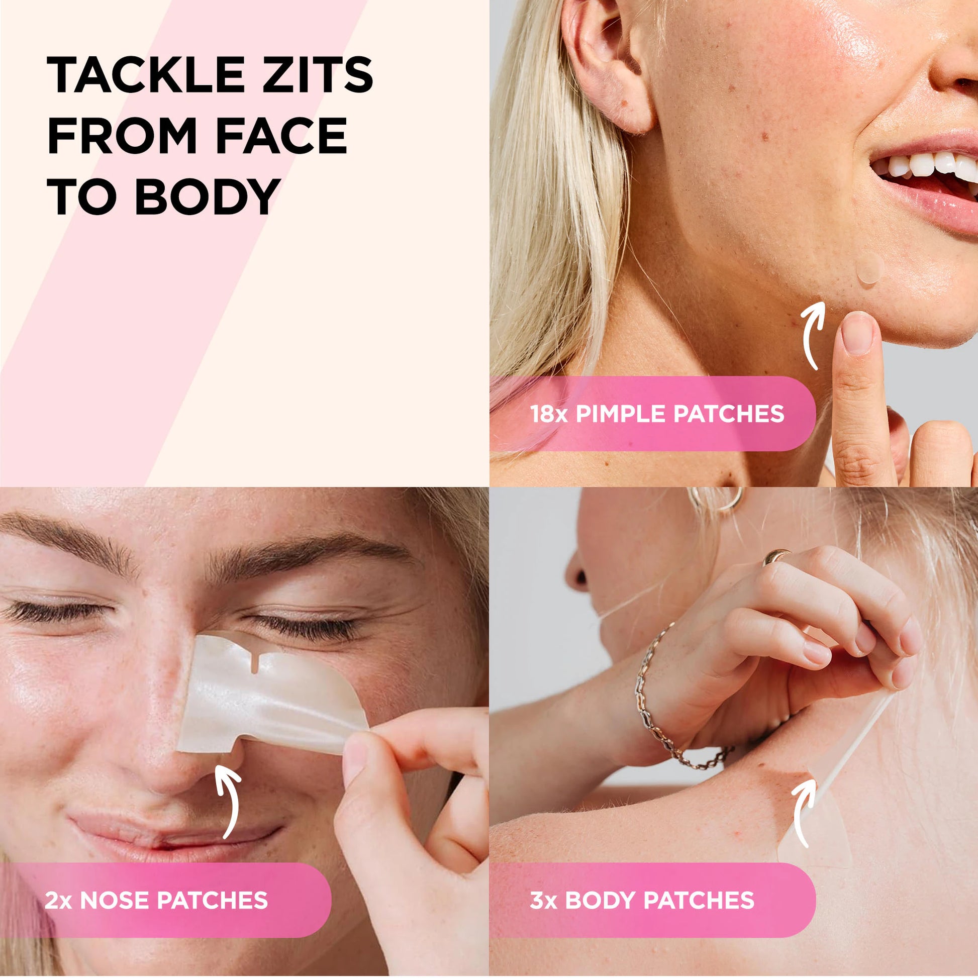 A woman uses the SUCKS TO BE GOO Kit's hydrocolloid patches on her face, nose, and back for pores.