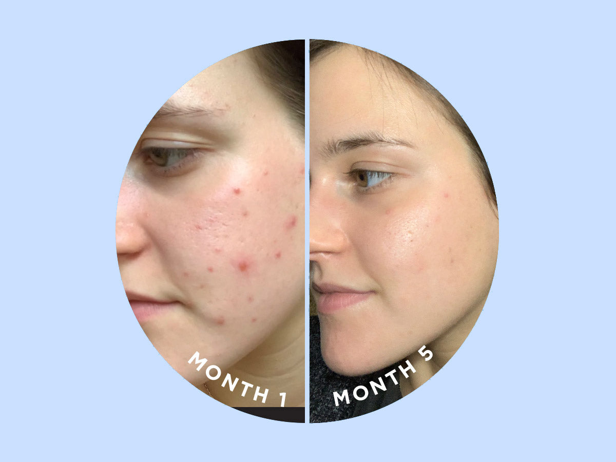 SKIN DISCIPLINE™
