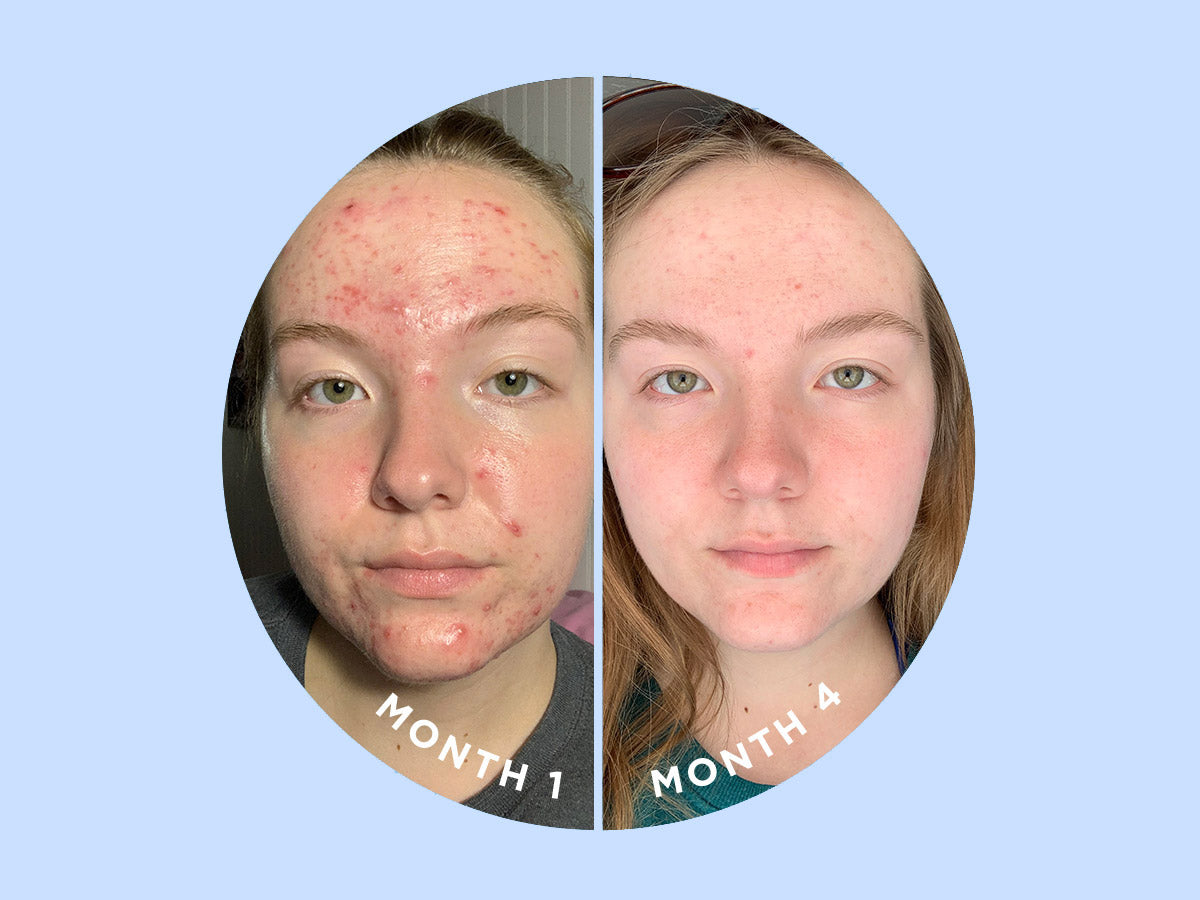 SKIN DISCIPLINE™